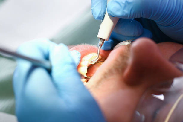 Best Emergency Root Canal Therapy in Blackshear, GA